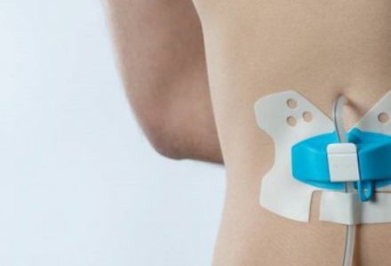 Case Study binnen de medische sector | Mavom